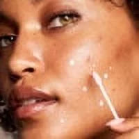 Acne Treatment 1 fl oz R313613